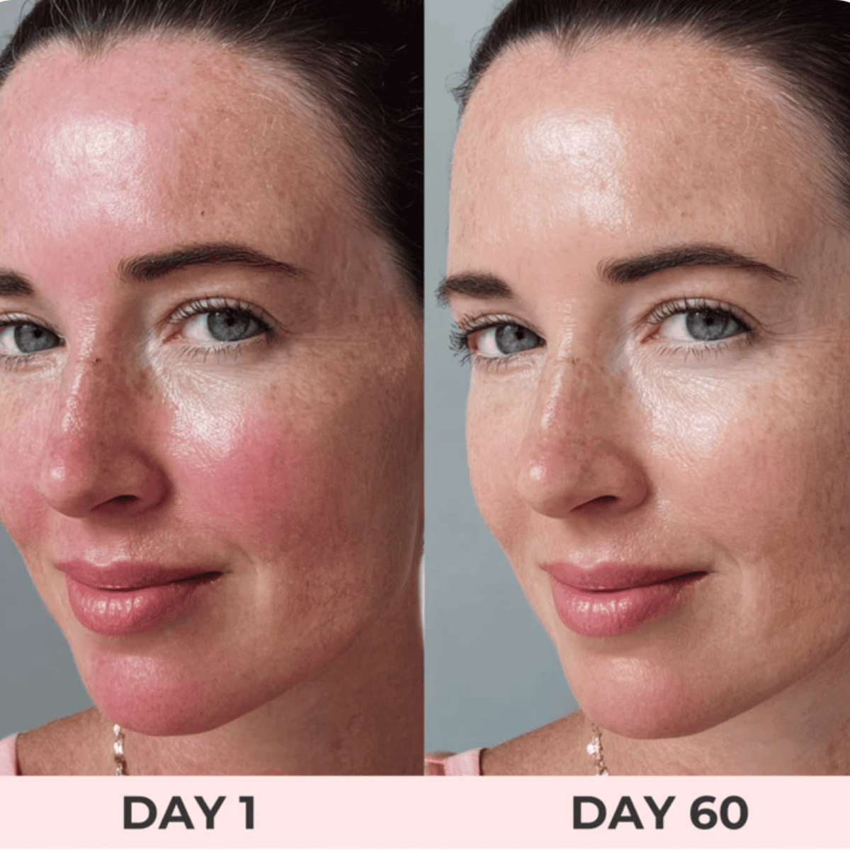 LumiGlow™ - Red Light Therapy Face Mask