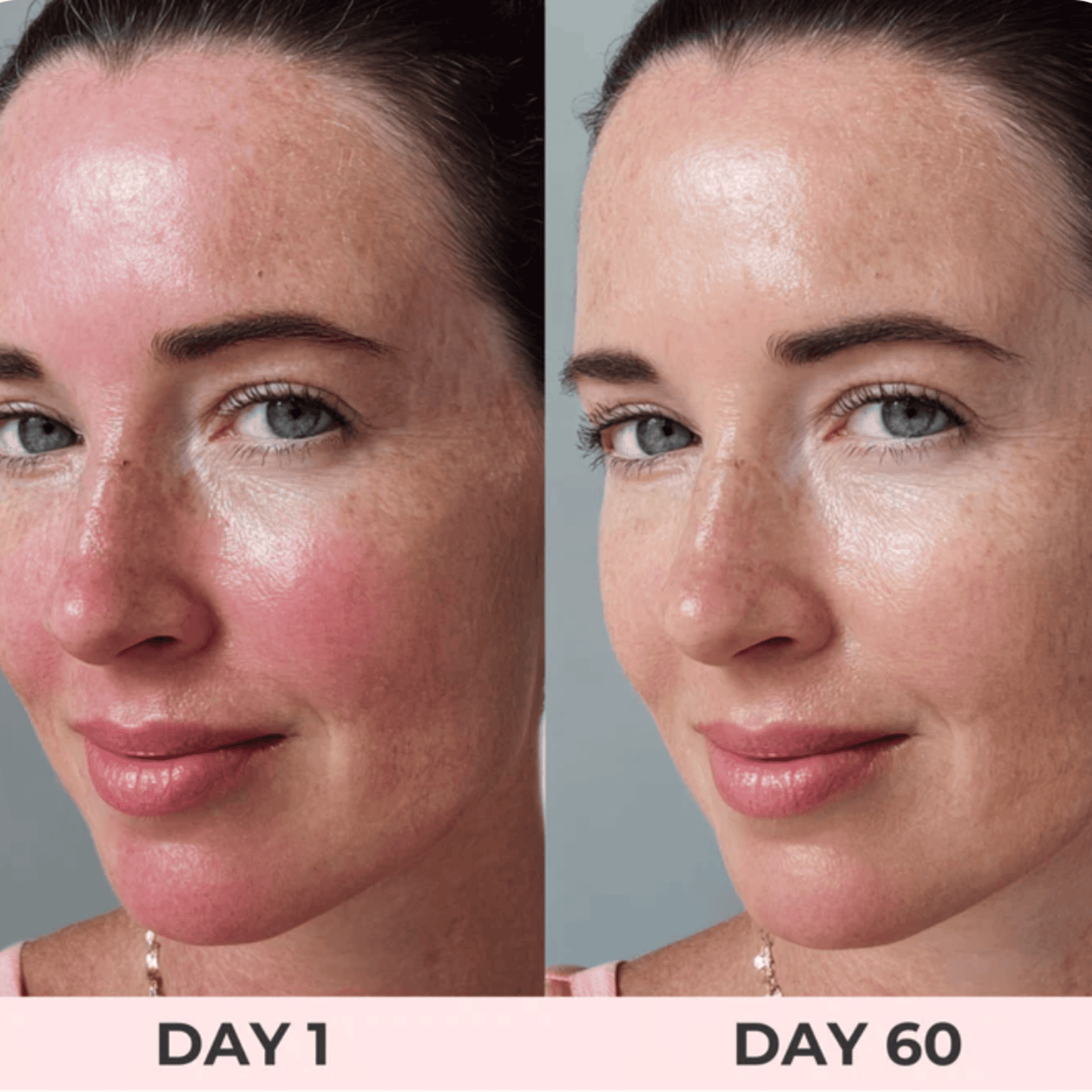 LumiGlow™ - Red Light Therapy Face Mask